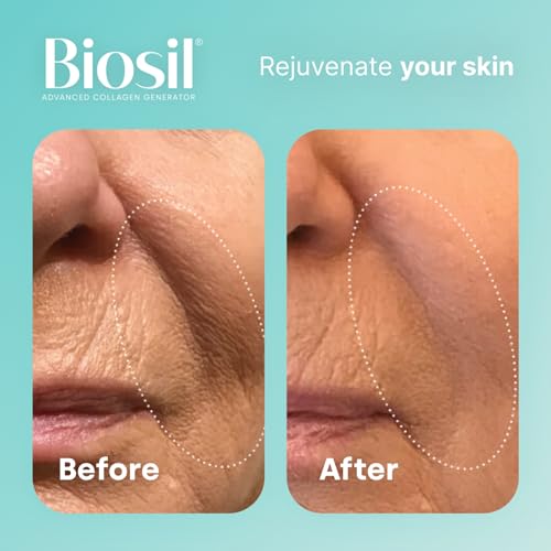 Biosil Collagen Generator - 120 Capsules - with Patented ch-OSA Complex - Generates & Protects BioSilBuy Supplements Australia