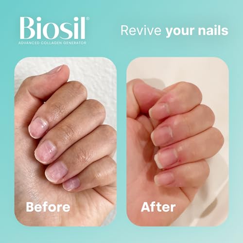 Biosil Collagen Generator - 60 Capsules - with Patented ch-OSA Complex - Generates & Protects Your Own Collagen BioSilBuy Supplements Australia