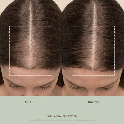 VEGAMOUR GRO+ Advanced Essentials Kit | Removes Buildup, Improves Hair Density, Reduces Shedding, Hydrates and Exfoliates the Scalp | For Severe Signs of Thinning | Color Safe, Vegan, Cruelty-Free VEGAMOURBuy Supplements Australia