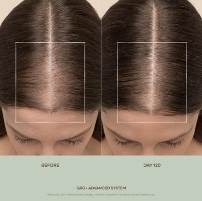 VEGAMOUR GRO+ Advanced Hair Serum for Improving Hair Density, Tonic Reduces Shedding and Promotes a Healthy Scalp, 3 pack VEGAMOURBuy Supplements Australia