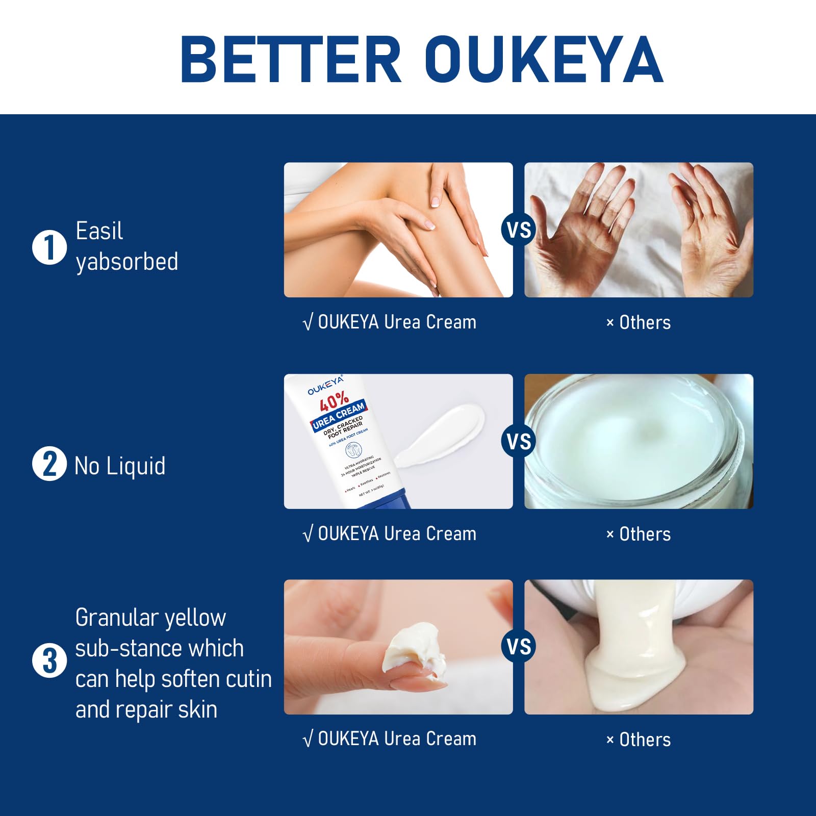 OUKEYA Urea Cream 40 Percent Tube 3 Oz, Foot & Hand Cream for Dry Cracked, 40 per Urea Lotion for Feet Maximum Strength OUKEYA buy supplements Au